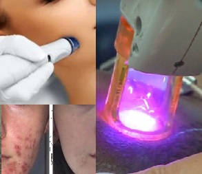 Aesthetics Lasers