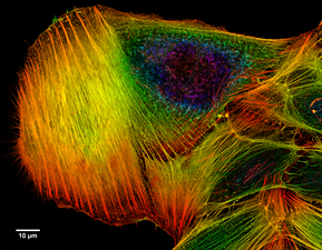 Confocal microscopy