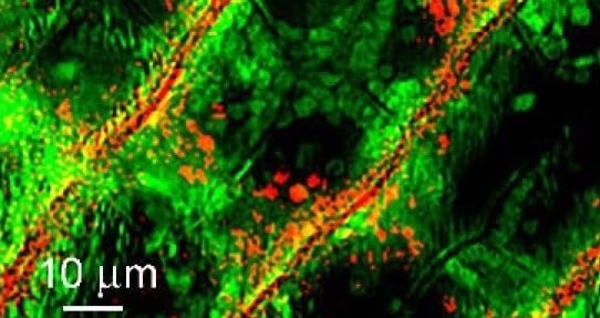 Raman Microscopy