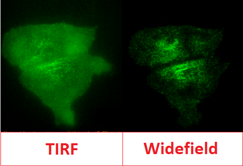 TIRF Microscopy-1