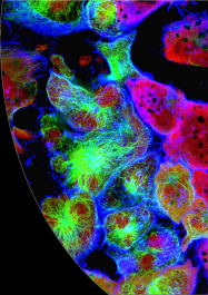 Image Confocal Microscopy