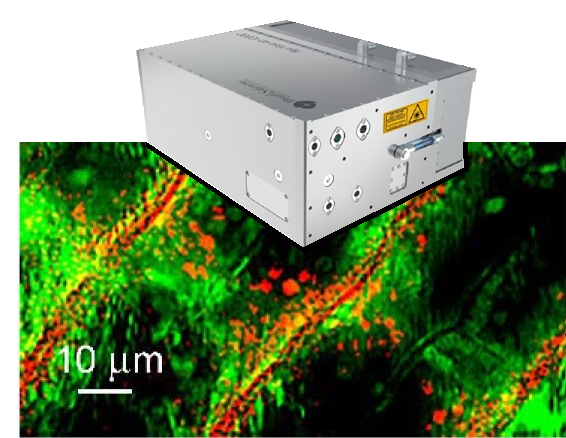 image of a sleek tunable laser system overlaying a microscopic image of aquatic plant material