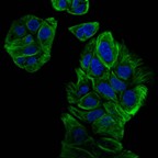 MULTI-PHOTON - Time lapse of human epithelial cells (60x, 1.4 NA, FOV 665 µm) - Overlay of 2P-460 nm (Hoechst, blue) & 2P-595 nm (SPY555-tubulin, green). DLD1 cells grew in ibidi 8-Well Slide for 1 day. Sample: VIVIT