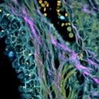 MULTI-PHOTON - Unstained human prostate (40x, NA 0.95, FOV 143 µm) - SHG-515 nm (magenta), 2P-542 (blue), 2P-625 (green) and 2P-700 (red)