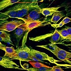 MULTI-PHOTON - Stained mouse fibroblasts (60x, 1.4 NA, FOV 160 µm) - 460 nm (blue), 542 nm (green) & 595 nm (red). Staining: DAPI - cell nuclei; Alexa Fluor 488 - microtubuli; Lifeact-RFP - actin filaments. Sample: University Konstanz.
