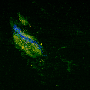 MPX microscope and femtosecond laser with label free mouse colon image