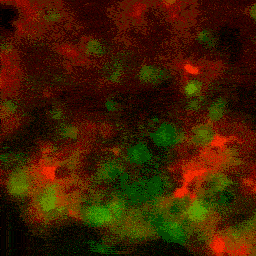 MPX microscope and femtosecond laser imaging neurons and astrocytes